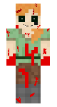 Bloody Alex