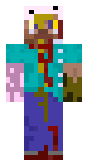 Infected guy
