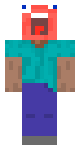 Traumatized Steve
