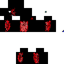 Kip - congenital analgesia skin